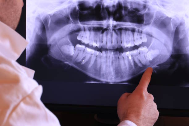 Best Emergency Dental Extractions in Webster, TX